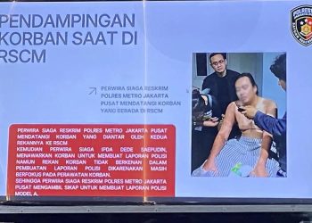 Update Medis Andrie Yunus: Kondisi Stabil di HCU RSCM, Tim Dokter Fokus Pemulihan Mata